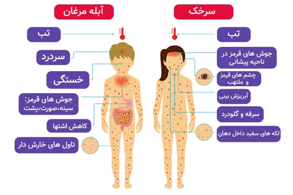 تفاوت آبله مرغان با سرخک