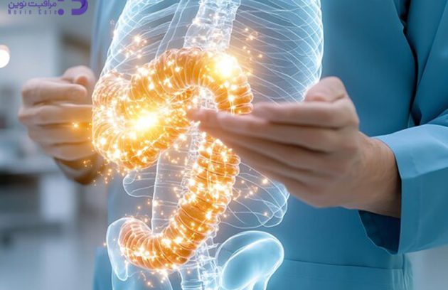 علائم سرطان روده در مراحل اولیه 2 شناخت علائم سرطان روده