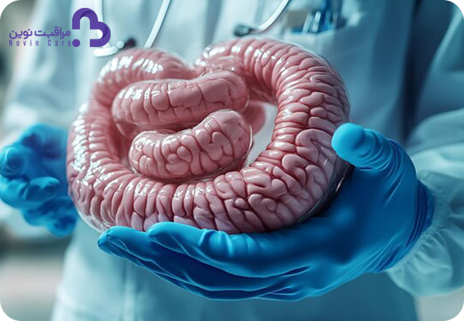 روش های درمان سرطان روده
