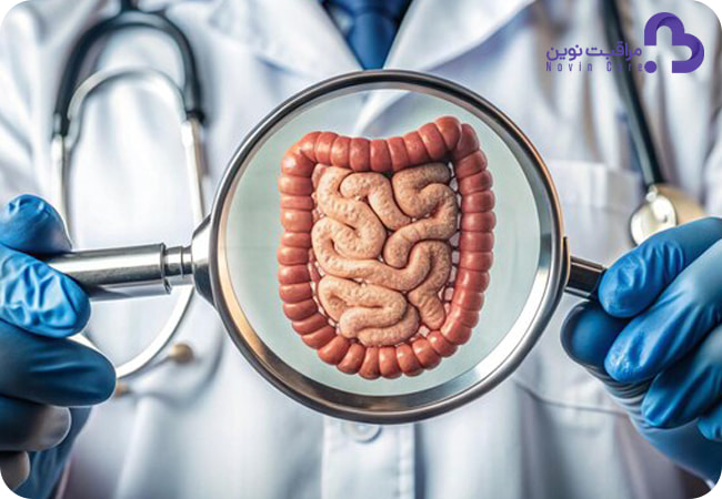 روش های پیشگیری از سرطان روده